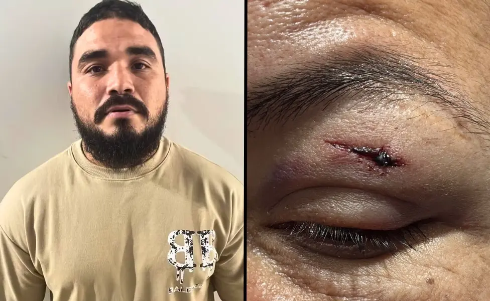 Cantor é denunciado por agressão em posto de combustíveis no Bujari; artista nega e diz que foi provocado