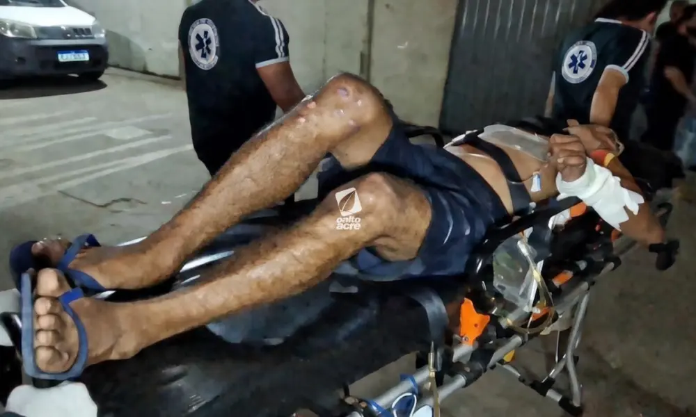 Noite de tiros em Brasiléia: dupla é baleada em ataque e atiradores fogem de moto