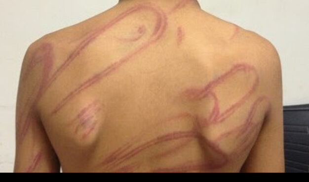 Pai é preso após agredir filho de 12 anos com cinto em Cruzeiro do Sul